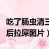 吃了腸蟲清三天后肛門口還有蟲（吃了腸蟲清后拉屎圖片）