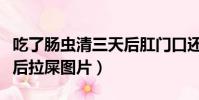吃了腸蟲清三天后肛門口還有蟲(吃了腸蟲清后拉屎圖片)