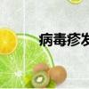 病毒疹發出來是好事嗎（病毒疹）
