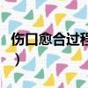 傷口愈合過程顏色變化圖（傷口愈合過程顏色）