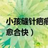 小孩縫針疤痕修復最佳方法（縫針傷口吃什么愈合快）
