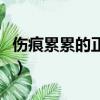 傷痕累累的正確讀音是什么（傷痕累累怎么讀）