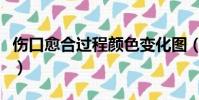 傷口愈合過程顏色變化圖(傷口愈合過程顏色)