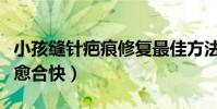 小孩縫針疤痕修復最佳方法(縫針傷口吃什么愈合快)