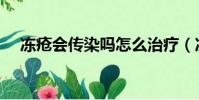 凍瘡會傳染嗎怎么治療(凍瘡會傳染嗎)