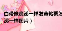 白帶像鼻涕一樣發黃粘稠怎么治療(白帶像鼻涕一樣圖片)