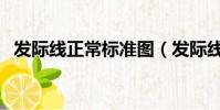 發際線正常標準圖(發際線正常位置圖片)