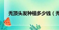 禿頂頭發種植多少錢(禿頂頭發種植)