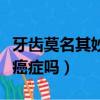 牙齒莫名其妙出血怎么回事（牙齒總是出血是癌癥嗎）