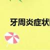 牙周炎癥狀圖片大全（牙周炎癥狀圖片）