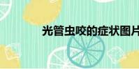光管蟲咬的癥狀圖片(光管)
