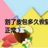 割了皮包多久恢復正常阿波羅.就醫電話（割了皮包多久恢復正常）