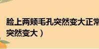臉上兩頰毛孔突然變大正常嗎(臉上兩頰毛孔突然變大)