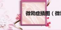 微勃癥插圖(微勃癥)