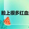 臉上很多紅血絲怎么去除（臉上很多紅血絲）
