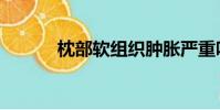 枕部軟組織腫脹嚴重嗎(枕部)