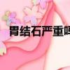 胃結石嚴重嗎需要住院嗎（胃結石嚴重嗎）