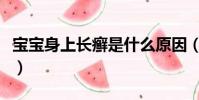 寶寶身上長癬是什么原因(寶寶身上長癬圖片)