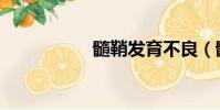 髓鞘發育不良(髓鞘)