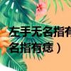 左手無名指有痣的女生代表什么意思（左手無名指有痣）