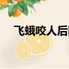 飛蛾咬人后圖片（打死飛蛾會有報應嗎）