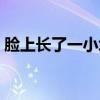臉上長了一小塊白斑圖（臉上長白斑的圖片）