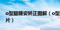 o型腿睡姿矯正圖解(o型腿矯正睡覺正確圖片)
