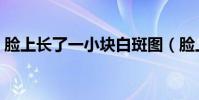 臉上長了一小塊白斑圖(臉上長白斑的圖片)