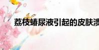 荔枝蝽尿液引起的皮膚潰爛(荔枝蝽)