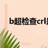 b超檢查crl是什么意思（crl是什么意思）