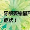牙齦萎縮最嚴重的牙齒圖片（牙齦萎縮圖片及癥狀）