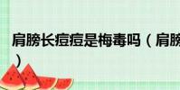 肩膀長痘痘是梅毒嗎(肩膀長痘痘是艾滋病嗎)