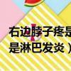右邊脖子疼是淋巴發炎引起的嗎（右邊脖子疼是淋巴發炎）