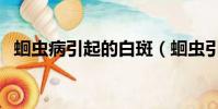 蛔蟲病引起的白斑(蛔蟲引起的白斑圖片)