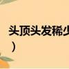 頭頂頭發稀少發型圖片男（頭頂頭發稀少發型）