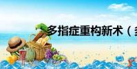多指癥重構新術(多指癥)