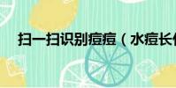 掃一掃識別痘痘(水痘長什么樣子圖片)