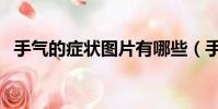 手氣的癥狀圖片有哪些(手氣的癥狀圖片)