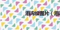 淚溝紋圖片(淚溝紋)