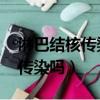 淋巴結核傳染嗎 有孩子怎么避免（淋巴結核傳染嗎）