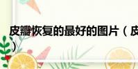 皮瓣恢復的最好的圖片(皮瓣手術是大手術嗎)