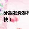 牙齦發炎怎樣才能好得快（牙齦發炎怎么治最快）