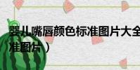 嬰兒嘴唇顏色標準圖片大全(嬰兒嘴唇顏色標準圖片)
