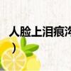 人臉上淚痕溝的圖片（人臉上有淚痕怎么去除）