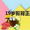 19歲駝背正骨有用嗎（19歲駝背是不是定型了）
