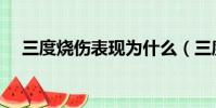 三度燒傷表現為什么(三度燒傷表現為)