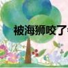 被海獅咬了會得狂犬病嗎（女孩被海獅）