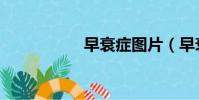 早衰癥圖片(早衰癥)