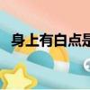 身上有白點是什么癥狀（身上有白點圖片）