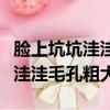 臉上坑坑洼洼毛孔粗大用什么藥膏（臉上坑坑洼洼毛孔粗大）